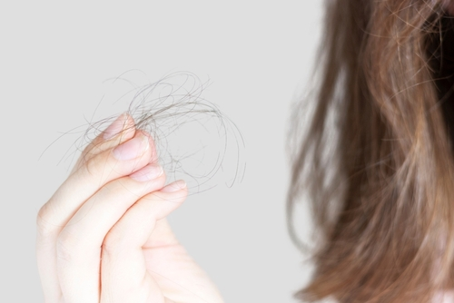 woman holding hair that fell from her head.